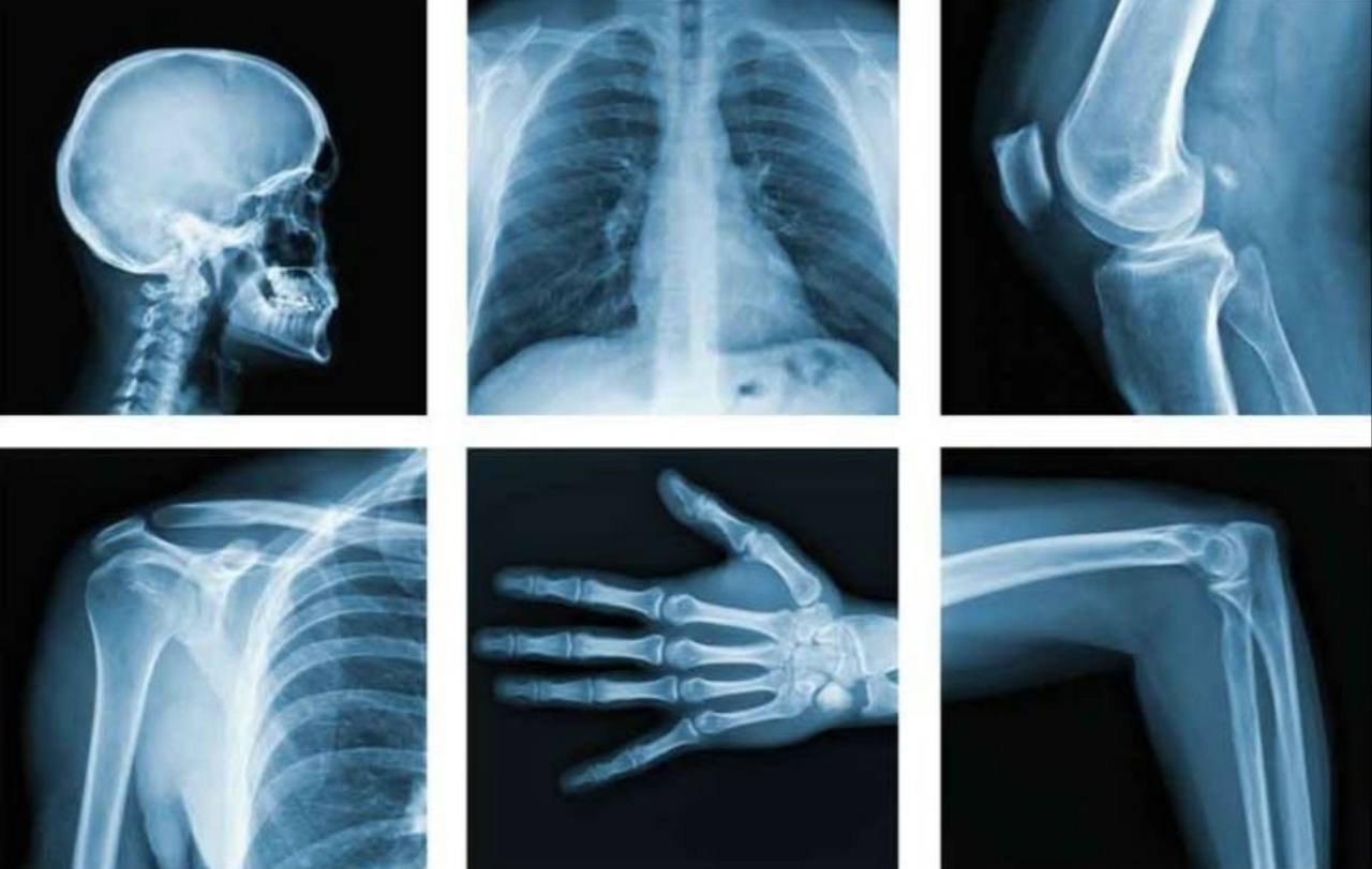 8 ноября – День рентгенолога!