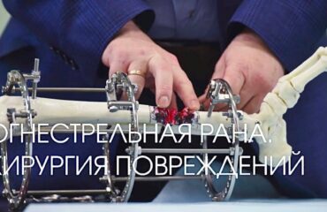 Современные подходы в хирургии повреждений