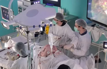 В НИИ применена инновационная методика лечения гигантских послеоперационных вентральных грыж